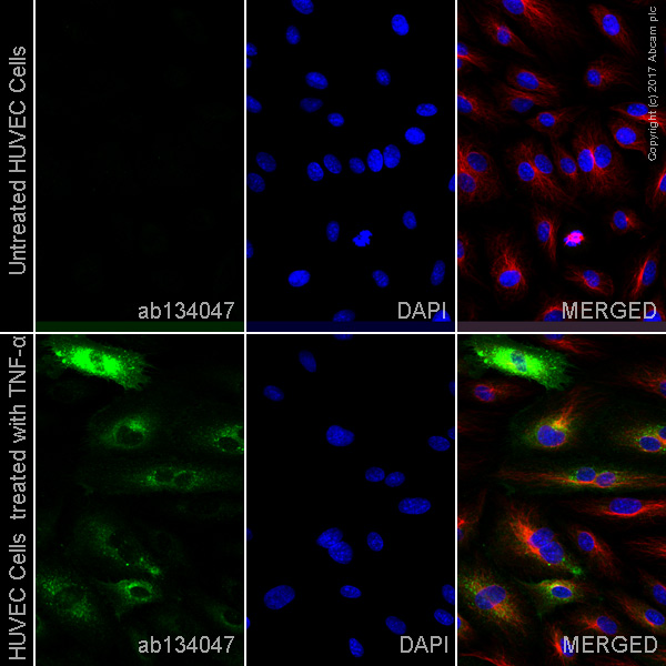 Immunocytochemistry/ Immunofluorescence - Anti-VCAM1 antibody [EPR5047] - Low endotoxin, Azide free (AB215380), expandable thumbnail