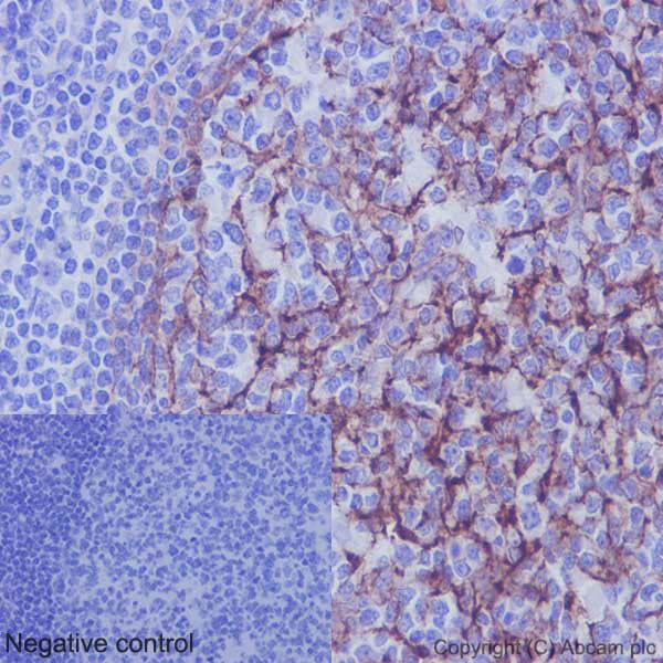 Immunohistochemistry (Formalin/PFA-fixed paraffin-embedded sections) - Anti-VCAM1 antibody [EPR5047] - Low endotoxin, Azide free (AB215380), expandable thumbnail