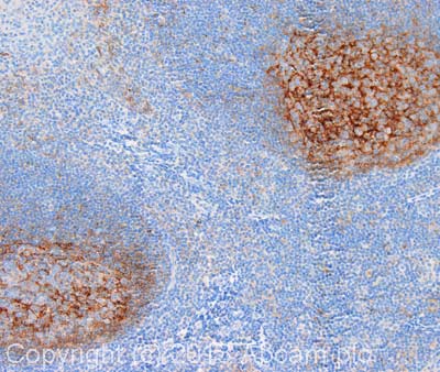 Immunohistochemistry (Formalin/PFA-fixed paraffin-embedded sections) - Anti-VCAM1 antibody [EPR5047] - Low endotoxin, Azide free (ab215380), expandable thumbnail