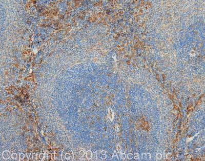 Immunohistochemistry (Formalin/PFA-fixed paraffin-embedded sections) - Anti-VCAM1 antibody [EPR5047] - Low endotoxin, Azide free (ab215380), expandable thumbnail