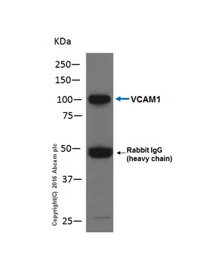 Immunoprecipitation - Anti-VCAM1 antibody [EPR5047] - Low endotoxin, Azide free (AB215380), expandable thumbnail