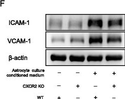 Western blot - Anti-VCAM1 antibody [EPR5047] - Low endotoxin, Azide free (ab215380), expandable thumbnail