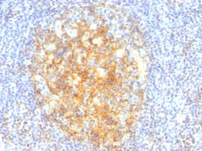 Immunohistochemistry (Formalin/PFA-fixed paraffin-embedded sections) - Anti-VCAM1 antibody [VCAM1/843] (AB216035)