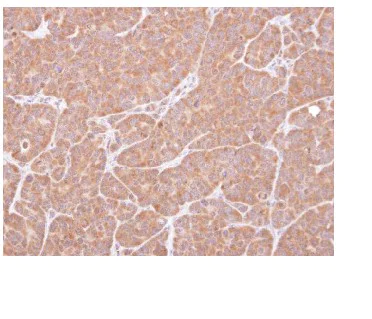 Immunohistochemistry (Formalin/PFA-fixed paraffin-embedded sections) - Anti-VCIP 135 antibody (AB97812)