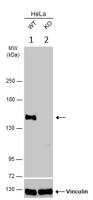 Western blot - Anti-VCIP 135 antibody (AB97812)