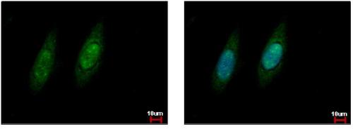 Immunocytochemistry/ Immunofluorescence - Anti-VCP antibody (AB155146), expandable thumbnail