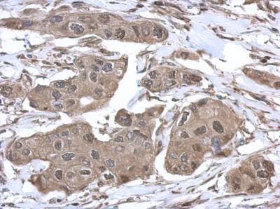Immunohistochemistry (Formalin/PFA-fixed paraffin-embedded sections) - Anti-VCP antibody (AB155146), expandable thumbnail