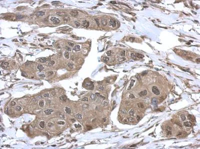 Immunohistochemistry (Formalin/PFA-fixed paraffin-embedded sections) - Anti-VCP antibody (AB155146)