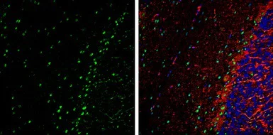 Immunohistochemistry (Frozen sections) - Anti-VCP antibody (AB155146)