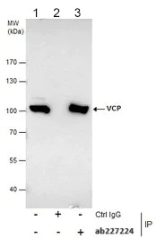 Immunoprecipitation - Anti-VCP antibody (AB155146)