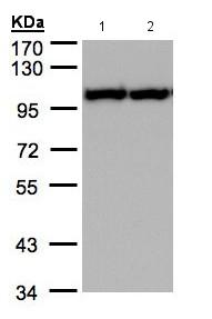 Western blot - Anti-VCP antibody (AB155146), expandable thumbnail
