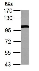 Western blot - Anti-VCP antibody (AB155146), expandable thumbnail