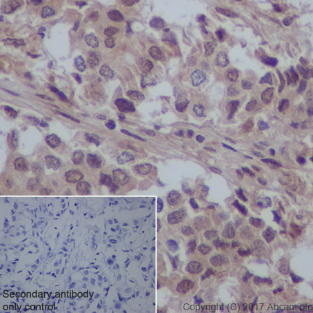 Immunohistochemistry (Formalin/PFA-fixed paraffin-embedded sections) - Anti-VCP antibody [EPR3307(2)] (AB109240), expandable thumbnail