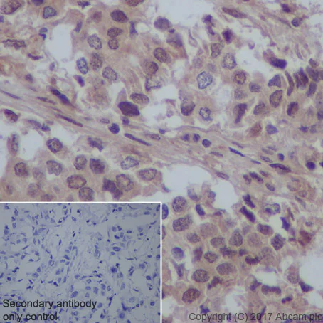 Immunohistochemistry (Formalin/PFA-fixed paraffin-embedded sections) - Anti-VCP antibody [EPR3307(2)] (AB109240)