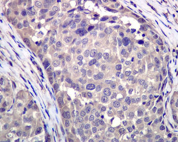 Immunohistochemistry (Formalin/PFA-fixed paraffin-embedded sections) - Anti-VCP antibody [EPR3307(2)] (ab109240), expandable thumbnail