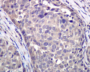 Immunohistochemistry (Formalin/PFA-fixed paraffin-embedded sections) - Anti-VCP antibody [EPR3307(2)] (AB109240)