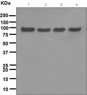 Western blot - Anti-VCP antibody [EPR3307(2)] (AB109240)