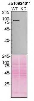 Western blot - Anti-VCP antibody [EPR3307(2)] (ab109240), expandable thumbnail