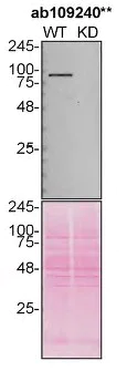 Western blot - Anti-VCP antibody [EPR3307(2)] (AB109240)