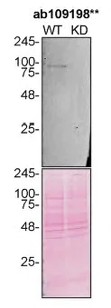 Western blot - Anti-VCP antibody [EPR3308] (AB109198)
