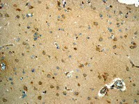 Immunohistochemistry (Formalin/PFA-fixed paraffin-embedded sections) - Anti-VCP antibody [EPR3308] - BSA and Azide free (AB247791)