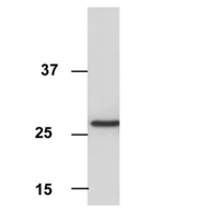 Western blot - Anti-VDAC1/Porin antibody [16G9E6BC4] - Mitochondrial Loading Control (AB110326)