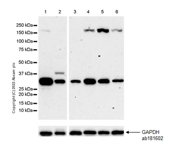 Western blot - Anti-VDAC1/Porin antibody [EPR27552-6] - Mitochondrial Loading Control (AB306581)
