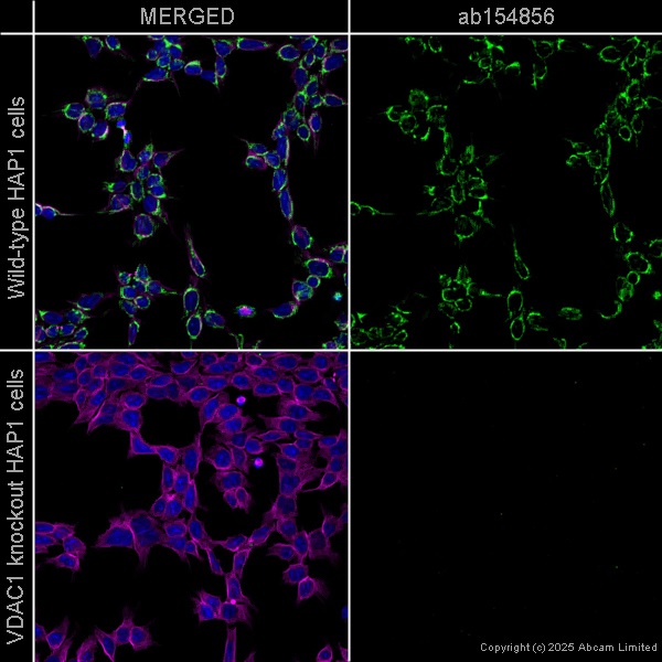 Anti-VDAC1/Porin + VDAC2 antibody [EPR10852(B)] - BSA and Azide free