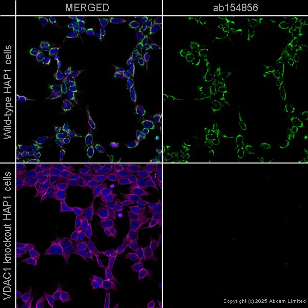 Immunocytochemistry/ Immunofluorescence - Anti-VDAC1/Porin + VDAC2 antibody [EPR10852(B)] - BSA and Azide free (AB240128)
