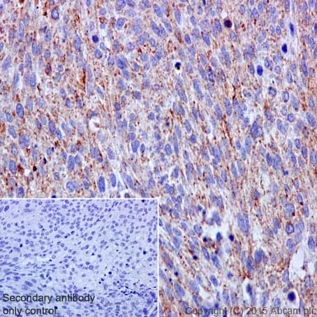 Immunohistochemistry (Formalin/PFA-fixed paraffin-embedded sections) - Anti-VDAC1/Porin + VDAC2 antibody [EPR10852(B)] - BSA and Azide free (AB240128)