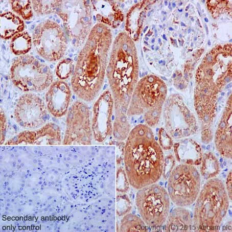 Immunohistochemistry (Formalin/PFA-fixed paraffin-embedded sections) - Anti-VDAC1/Porin + VDAC2 antibody [EPR10852(B)] - BSA and Azide free (AB240128)