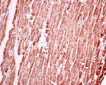 Immunohistochemistry (Formalin/PFA-fixed paraffin-embedded sections) - Anti-VDAC1/Porin + VDAC2 antibody [EPR10852(B)] - BSA and Azide free (AB240128)