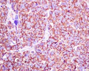 Immunohistochemistry (Formalin/PFA-fixed paraffin-embedded sections) - Anti-VDAC1/Porin + VDAC2 antibody [EPR10852(B)] - BSA and Azide free (AB240128)