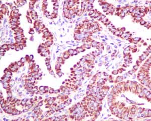 Immunohistochemistry (Formalin/PFA-fixed paraffin-embedded sections) - Anti-VDAC1/Porin + VDAC2 antibody [EPR10852(B)] - BSA and Azide free (AB240128)