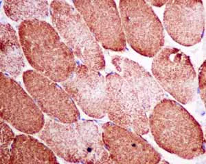Immunohistochemistry (Formalin/PFA-fixed paraffin-embedded sections) - Anti-VDAC1/Porin + VDAC2 antibody [EPR10852(B)] - BSA and Azide free (AB240128)