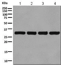 Western blot - Anti-VDAC1/Porin + VDAC2 antibody [EPR10852(B)] - Mitochondrial Loading Control (AB154856)