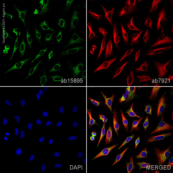 Immunocytochemistry/ Immunofluorescence - Anti-VDAC1/Porin + VDAC2 + VDAC3 antibody – Mitochondrial Loading Control (AB15895), expandable thumbnail
