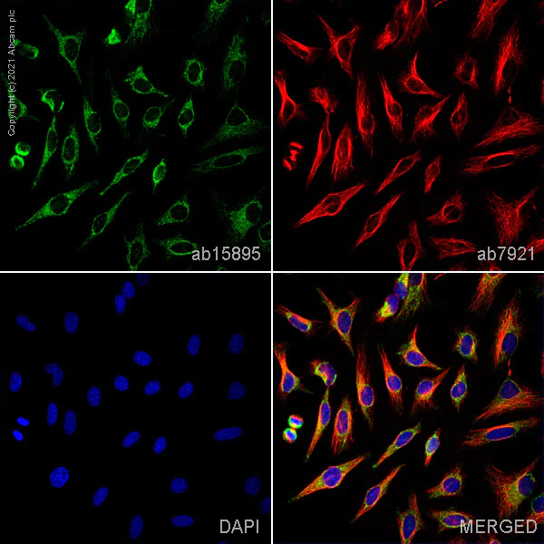 Immunocytochemistry/ Immunofluorescence - Anti-VDAC1/Porin + VDAC2 + VDAC3 antibody – Mitochondrial Loading Control (AB15895)