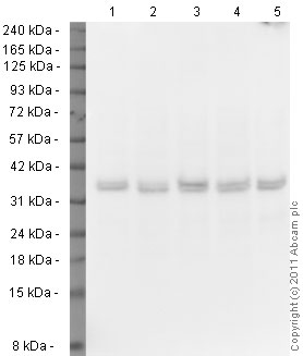 Western blot - Anti-VDAC1/Porin + VDAC2 + VDAC3 antibody – Mitochondrial Loading Control (ab15895), expandable thumbnail