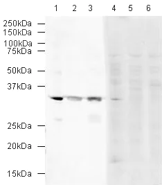 Western blot - Anti-VDAC1/Porin + VDAC2 + VDAC3 antibody – Mitochondrial Loading Control (AB15895)