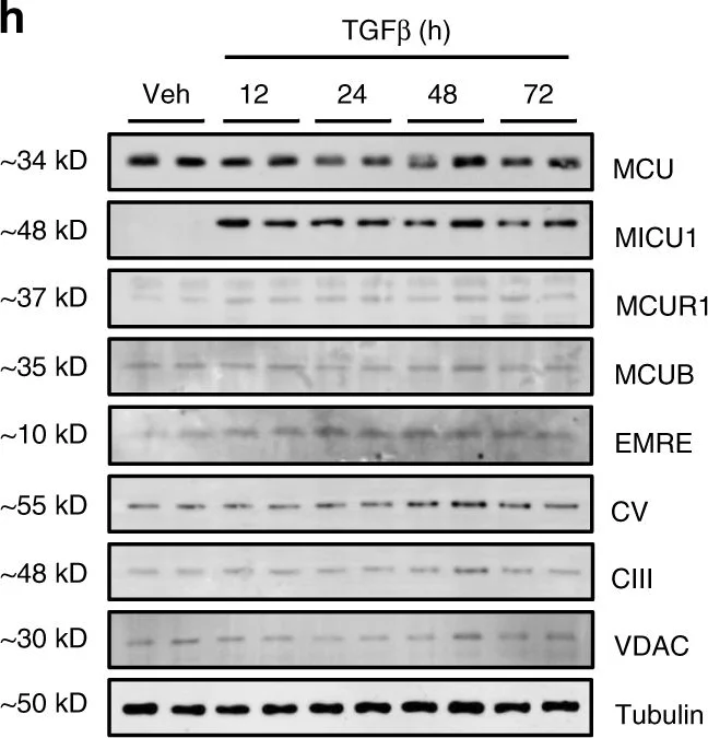 Western blot - Anti-VDAC1/Porin + VDAC2 + VDAC3 antibody – Mitochondrial Loading Control (AB15895)