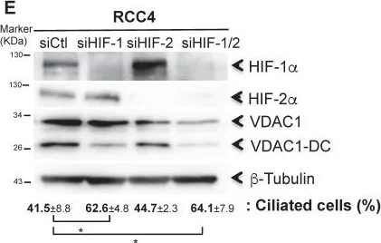 Western blot - Anti-VDAC1/Porin + VDAC2 + VDAC3 antibody – Mitochondrial Loading Control (AB15895)