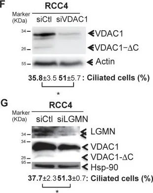 Western blot - Anti-VDAC1/Porin + VDAC2 + VDAC3 antibody – Mitochondrial Loading Control (AB15895)