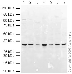 Western blot - Anti-VDAC1/Porin + VDAC2 + VDAC3 antibody – Mitochondrial Loading Control (AB15895), expandable thumbnail