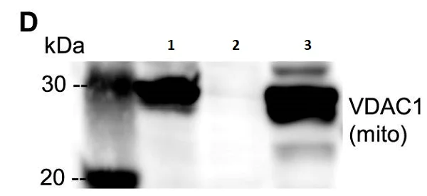Western blot - Anti-VDAC1/Porin + VDAC3 antibody [20B12AF2] - Mitochondrial Loading Control (AB14734)