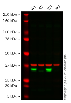 Western blot - Anti-VDAC1/Porin + VDAC3 antibody [20B12AF2] - Mitochondrial Loading Control (AB14734), expandable thumbnail