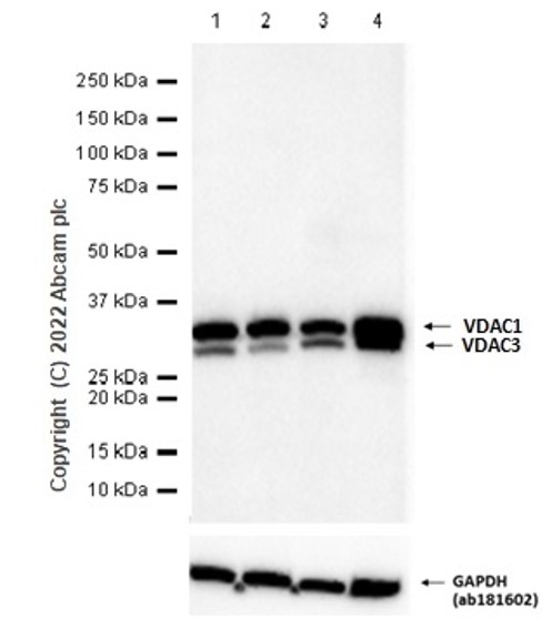 Western blot - Anti-VDAC1/Porin + VDAC3 antibody [20B12AF2] - Mitochondrial Loading Control (ab14734), expandable thumbnail