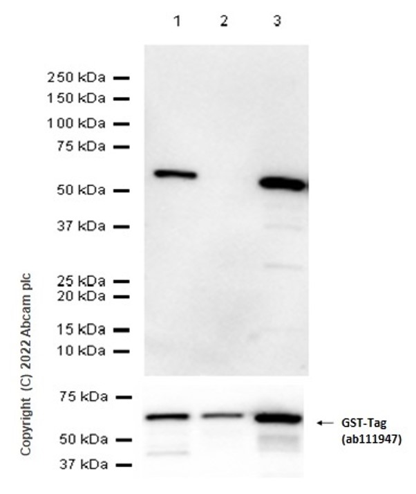 Western blot - Anti-VDAC1/Porin + VDAC3 antibody [20B12AF2] - Mitochondrial Loading Control (AB14734), expandable thumbnail