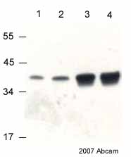 Western blot - Anti-VDAC1/Porin + VDAC3 antibody [20B12AF2] - Mitochondrial Loading Control (ab14734), expandable thumbnail