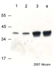 Western blot - Anti-VDAC1/Porin + VDAC3 antibody [20B12AF2] - Mitochondrial Loading Control (AB14734)